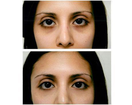 Case 7126 - Carboxy Gallery (Before & After)