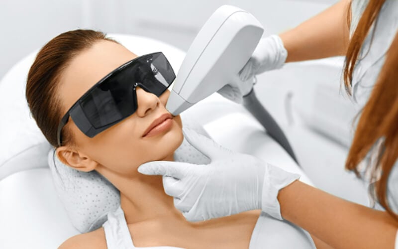 benfits of laser hair removal on face