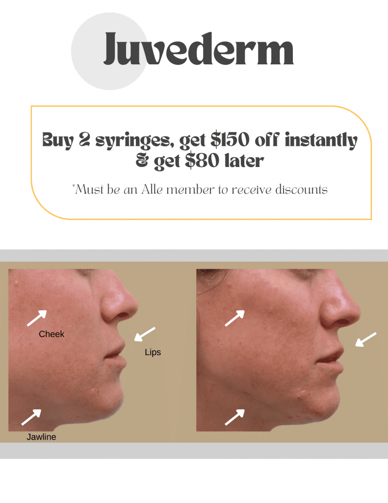 August_Specials_Juvederm-791x1024