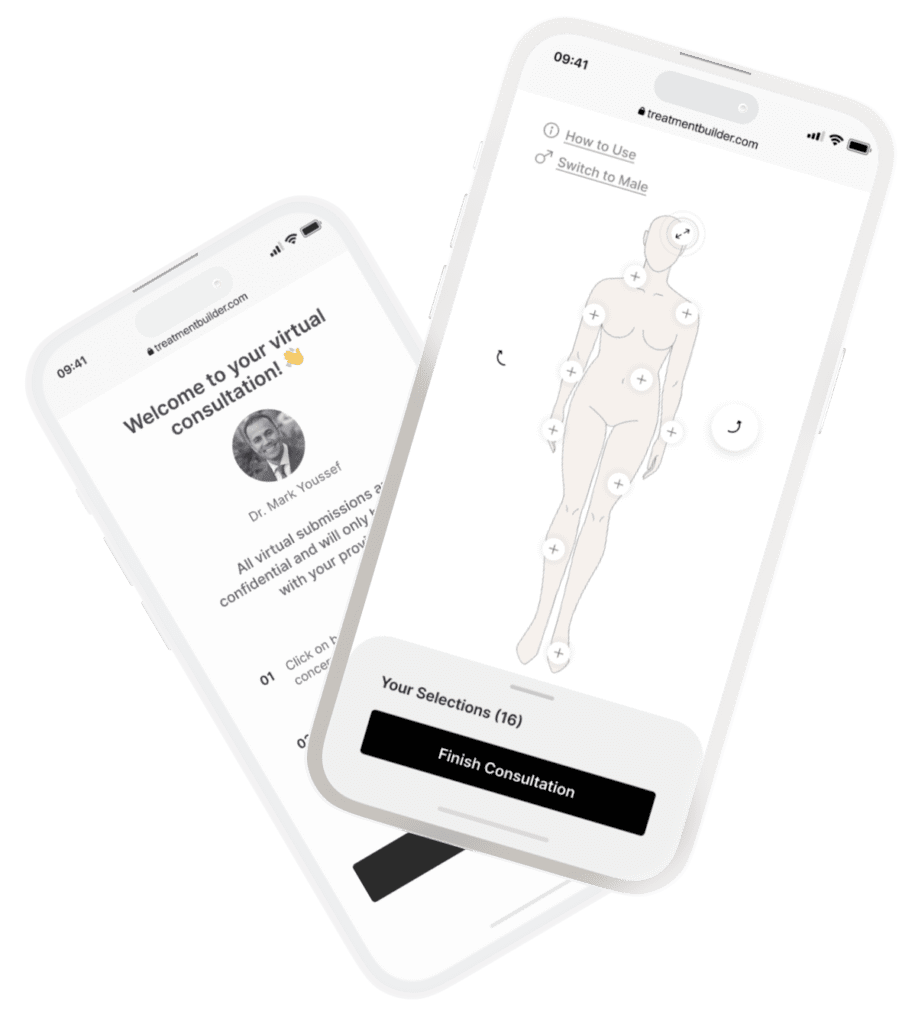 Sun Damage Younique Surgery Center & Medical Spa