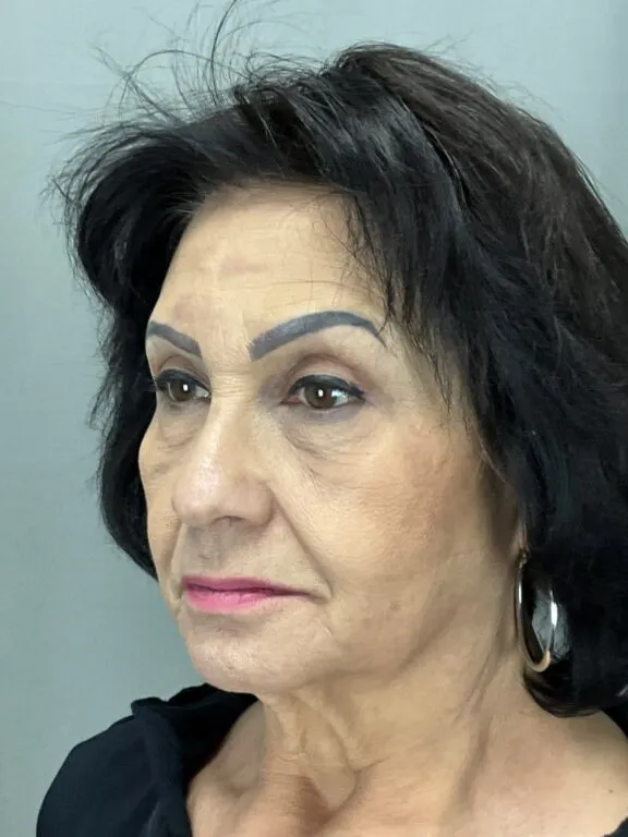Older woman with makeup, showing before cosmetic procedure profile.