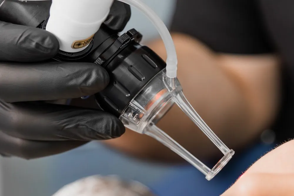Laser skin treatment procedure at plastic surgery center.