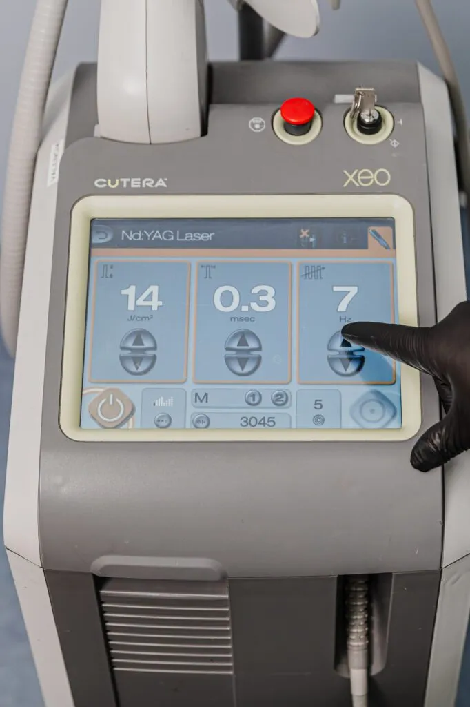 Nd:YAG laser machine interface being adjusted by a gloved hand at a plastic surgery center.