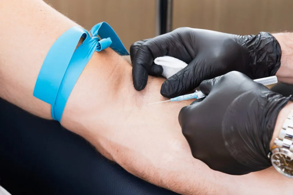 Injection procedure at a plastic surgery center with a blue tourniquet and black gloves.