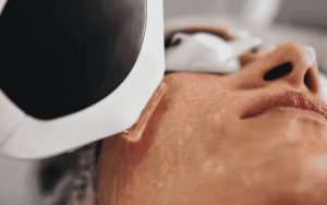 patient receiving laser treatment