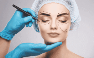 marking for facelift